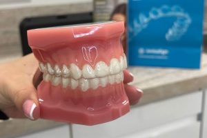 invisalign clear aligners cambridge dentist